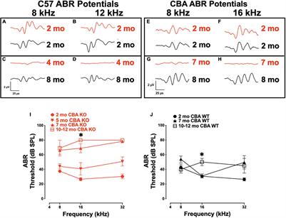 Deletion of Oncomodulin Gives Rise to Early Progressive Cochlear Dysfunction in C57 and CBA Mice